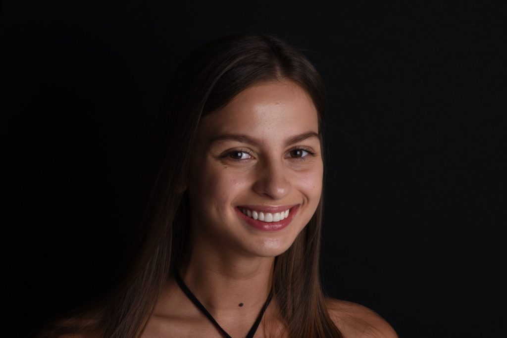 Smile Design Dubai - Before and after Kate