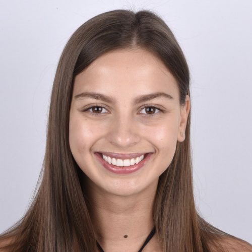 Smile Design - Before and after Kate 004